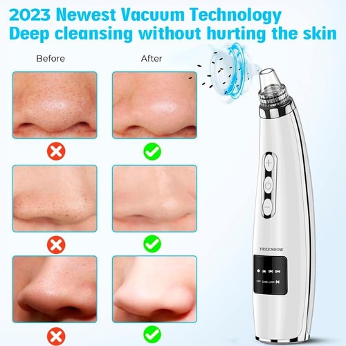 2023 best blackhead vacuum - 2023,